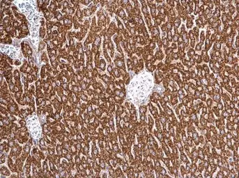 Anti-HSC70 antibody [N2C1], Internal used in IHC (Paraffin sections) (IHC-P). GTX111069