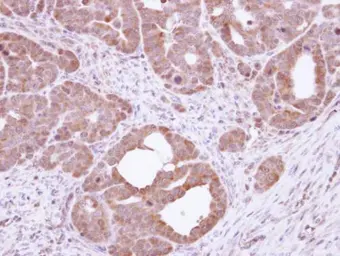 Anti-HSC70 antibody [N2C1], Internal used in IHC (Paraffin sections) (IHC-P). GTX111069