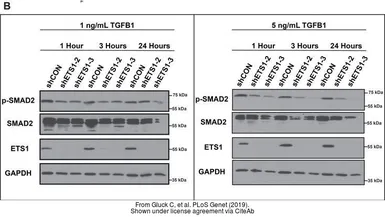 Anti-SMAD2 antibody used in Western Blot (WB). GTX111075