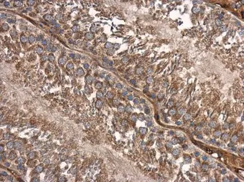 Anti-SMAD2 antibody used in IHC (Paraffin sections) (IHC-P). GTX111075