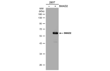 Anti-SMAD2 antibody used in Western Blot (WB). GTX111075