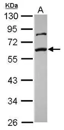 Anti-SMAD2 antibody used in Western Blot (WB). GTX111075