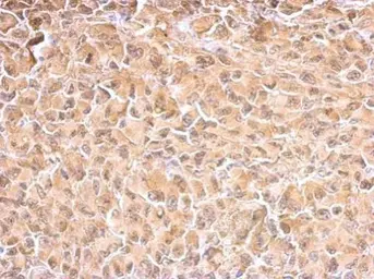 Anti-Hsp70 antibody used in IHC (Paraffin sections) (IHC-P). GTX111088