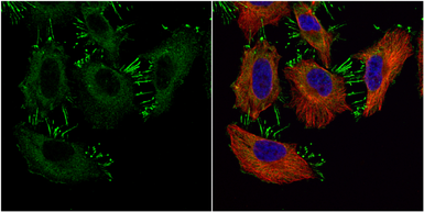 Anti-alpha 1 Catenin antibody [N3C2], Internal used in Immunocytochemistry/ Immunofluorescence (ICC/IF). GTX111095