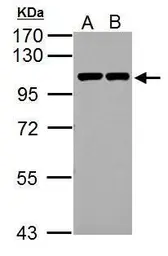 Anti-alpha 1 Catenin antibody [N3C2], Internal used in Western Blot (WB). GTX111095