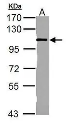 Anti-alpha 1 Catenin antibody [N3C2], Internal used in Western Blot (WB). GTX111095