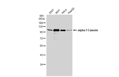 Anti-alpha 1 Catenin antibody [N3C2], Internal used in Western Blot (WB). GTX111095