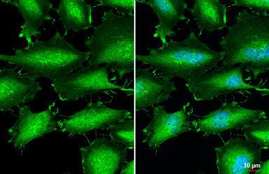 Anti-alpha 1 Catenin antibody [N3C2], Internal used in Immunocytochemistry/ Immunofluorescence (ICC/IF). GTX111095