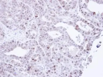 Anti-MCM3 antibody [C2C3], C-term used in IHC (Paraffin sections) (IHC-P). GTX111102