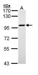 Anti-MCM3 antibody [C2C3], C-term used in Western Blot (WB). GTX111102