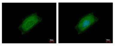 Anti-Cyclin B2 antibody used in Immunocytochemistry/ Immunofluorescence (ICC/IF). GTX111118