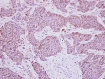 Anti-MEK5 antibody [N1N3] used in IHC (Paraffin sections) (IHC-P). GTX111129