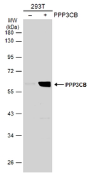 Anti-PPP3CB antibody [N1N3] used in Western Blot (WB). GTX111141