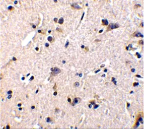 Anti-GDNF Receptor alpha 1 antibody used in IHC (Paraffin sections) (IHC-P). GTX11115