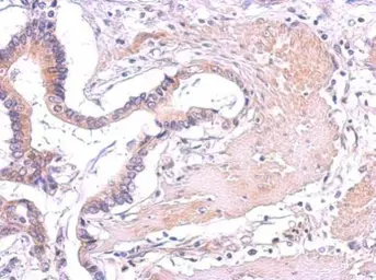 Anti-PLCG2 antibody used in IHC (Paraffin sections) (IHC-P). GTX111178