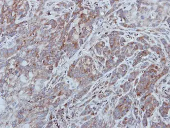 Anti-UNC13B antibody [N3C1], Internal used in IHC (Paraffin sections) (IHC-P). GTX111179