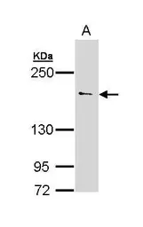 Anti-UNC13B antibody [N3C1], Internal used in Western Blot (WB). GTX111179