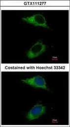 Anti-CARD6 antibody [C1C3] used in Immunocytochemistry/ Immunofluorescence (ICC/IF). GTX111277