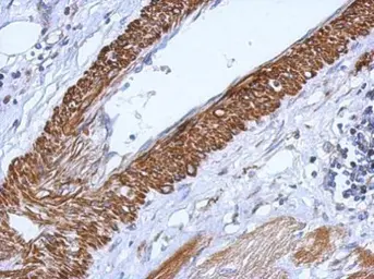 Anti-CARD6 antibody [C1C3] used in IHC (Paraffin sections) (IHC-P). GTX111277