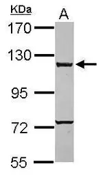 Anti-CARD6 antibody [C1C3] used in Western Blot (WB). GTX111277