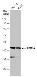 Anti-PPM1A antibody used in Western Blot (WB). GTX111288