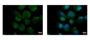 Anti-PPM1A antibody used in Immunocytochemistry/ Immunofluorescence (ICC/IF). GTX111288