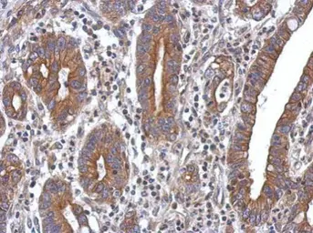 Anti-PPM1A antibody used in IHC (Paraffin sections) (IHC-P). GTX111288