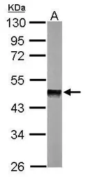 Anti-PPM1A antibody used in Western Blot (WB). GTX111288