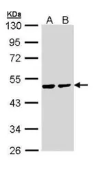 Anti-PPM1A antibody used in Western Blot (WB). GTX111288