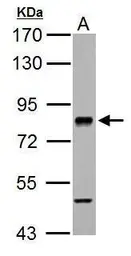 Anti-RSK2 antibody used in Western Blot (WB). GTX111302