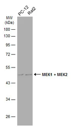 Anti-MEK1 + MEK2 antibody used in Western Blot (WB). GTX111338