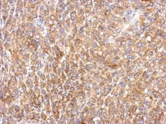 Anti-MEK1 + MEK2 antibody used in IHC (Paraffin sections) (IHC-P). GTX111338