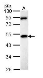 Anti-MPP1 antibody [N3C3] used in Western Blot (WB). GTX111341