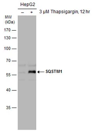 Anti-SQSTM1 / P62 antibody used in Western Blot (WB). GTX111393