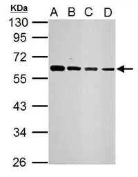 Anti-SQSTM1 / P62 antibody used in Western Blot (WB). GTX111393