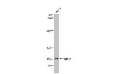 Anti-DDR1 antibody [N1N3] used in Western Blot (WB). GTX111453