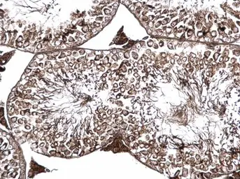 Anti-PSKH1 antibody used in IHC (Paraffin sections) (IHC-P). GTX111473