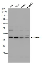 Anti-PSKH1 antibody used in Western Blot (WB). GTX111473