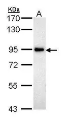 Anti-ZAK antibody [N1N2], N-term used in Western Blot (WB). GTX111477