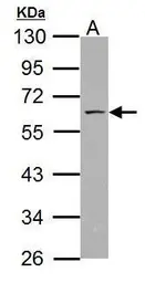 Anti-SSH3BP1 antibody used in Western Blot (WB). GTX111478