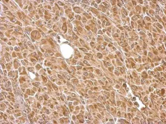 Anti-Hexokinase II antibody used in IHC (Paraffin sections) (IHC-P). GTX111525