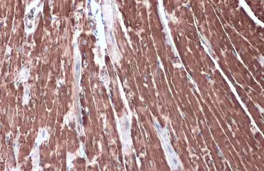 Anti-Hexokinase II antibody used in IHC (Paraffin sections) (IHC-P). GTX111525