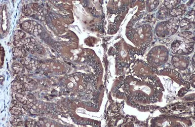 Anti-Hexokinase II antibody used in IHC (Paraffin sections) (IHC-P). GTX111525