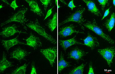 Anti-Hexokinase II antibody used in Immunocytochemistry/ Immunofluorescence (ICC/IF). GTX111525