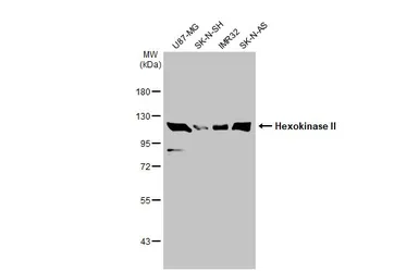 Anti-Hexokinase II antibody used in Western Blot (WB). GTX111525