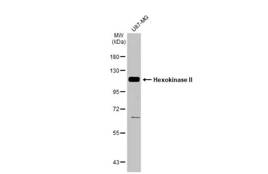 Anti-Hexokinase II antibody used in Western Blot (WB). GTX111525