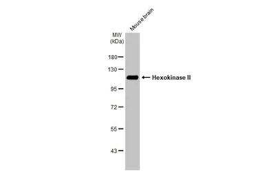 Anti-Hexokinase II antibody used in Western Blot (WB). GTX111525