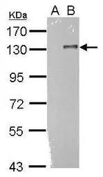 Anti-TLR9 antibody [N1N2], N-term used in Western Blot (WB). GTX111547