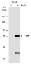 Anti-Raf1 antibody [N1C1-2] used in Western Blot (WB). GTX111588