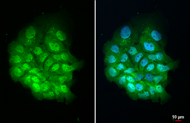 Anti-BTK antibody used in Immunocytochemistry/ Immunofluorescence (ICC/IF). GTX111592